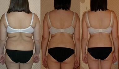 būdai numesti 7 kg per savaitę